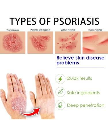 Beeergift Salbe Cream for Psoriasis | Professional Bee Venom Skin Repair | Soothing Care & Itch Relief - 2 Pieces - Buy Online on GoSupps.com