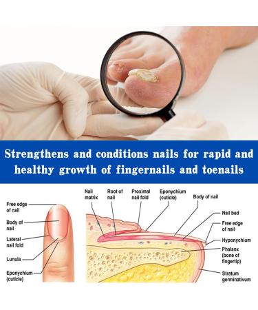 Fungal Nail Treatment 30ML Nail Fungus Serum for Toenail Extra Strong Gentle Anti Fungal Nail Serum Protects Thick Broken Discolored Nails Restoring Healthy Nails For Finger And Toe Nail Fungal - Buy Online on GoSupps.com