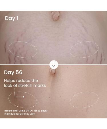 MA LYS B-FLAT Belly Firming Cream for Women - Skin Tightening & Moisturizing Treatment with Shea Butter & Bentonite Clay - Smooths Look of Stretch Marks - Postpartum Body Care (2 Pack) 3.38 Fl Oz (Pack of 2) - Buy Online on GoSupps.com