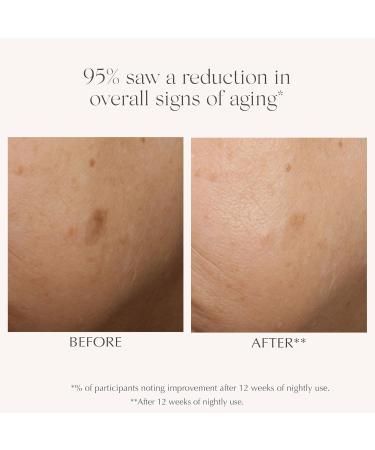 EXUVIANCE AGE REVERSE+ Advanced Renewal Retinol Overnight Serum Anti-Aging Wrinkle Reducer with 0.3% Pure Retinol Niacinamide NeoGlucosamine Hyaluronic Acid & Centella Asiatica 30ml/1 fl oz - Buy Online on GoSupps.com