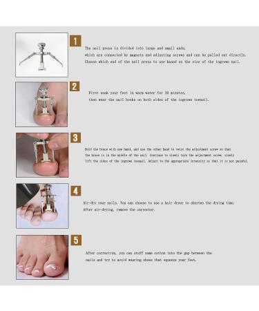 Ingrown Toenails Set Nail Correction Clip Toenail Correction Set Ingrown Toenail Correction Patch for Paronychia Ingrown Toenails Protects Toenails - Buy Online on GoSupps.com