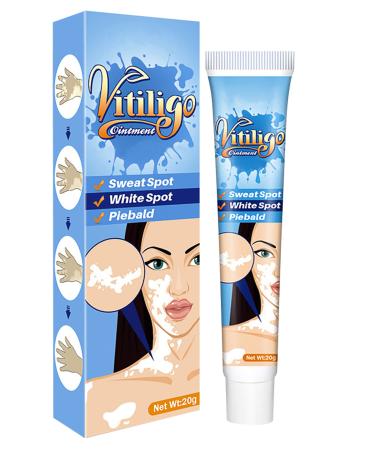 Xshows Vitiligo Cream  Vitiligo Treatment for Reduce White Spots and Improve Skin Pigmentation