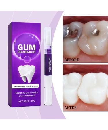 Dental Care Gel Portable Stain Removal - Whitening Dental Care For Adults Teens Family Travel Home Outdoors - Buy Online on GoSupps.com