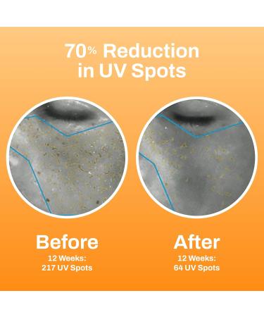 Photozyme Petite Duo Travel Set Anti-Aging Skincare Kit with DNA Repair Serum & 0.5% Retinol Night Serum Travel Size Hydrating & Brightening Serums for Fine Lines & Sun Damage Two 0.5 fl oz - Buy Online on GoSupps.com