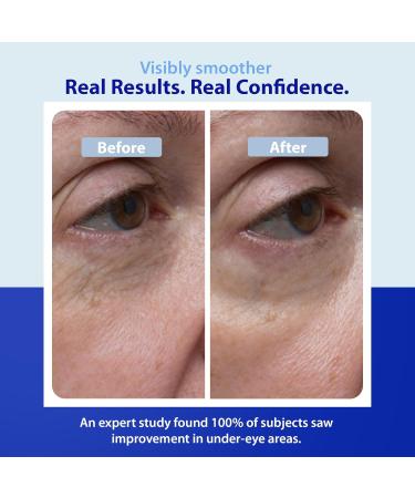 Dr. Denese SkinScience Firming Facial Collagen Eye Cream 1oz Hydrating Under Eye Treatment with Hyaluronic Acid Peptides & Ceramides for Puffiness Dark Circles Fine Lines Cruelty-Free Skin Care 1 Fl Oz (Pack of 1) - Buy Online on GoSupps.com