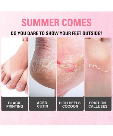 Rose Foot Peel Mask For Hard Skin Rose Foot Peel Mask Rose Foot Mask Exfoliating Feet Peeling Socks Foot Care Mask Plant Formula Moisturising Socks Foot Spa Fits for Women and Men(2 Pairs) - Buy Online on GoSupps.com