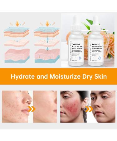 Hyaluronic Acid 2% + B5 Facial Serum 2 PCS Hyaluronic Acid Serum For Face Moisturizing. 2% Hyaluronic Acid - 2PCS - Buy Online on GoSupps.com