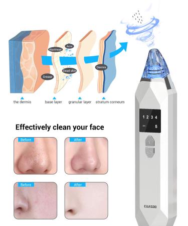 EUASOO Blackhead Remover Vacuum Kit | USB Rechargeable Facial Pore Cleanser with 5 Probes and 5 Suction Power Levels for Skin Treatment - Buy Online on GoSupps.com