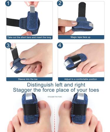 Buy Hammer Toe Corrector for Men & Women | 4-Piece Toe Straightener Set | Practical Support & Wraps for Curled & Broken Toes (Blue - Buy Online on GoSupps.com