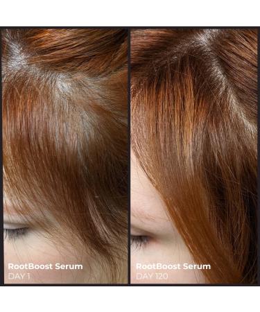 EVOLVh Better Roots RootBoost Serum - Natural Scalp Wellness + Hair Regrowth | Vegan, Non-Toxic, Clean Hair Care (1 fl oz | 30 ml) - Buy Online on GoSupps.com