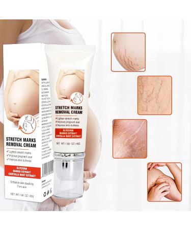 Remove Stretch Marks Cream | Body Repair Cream with Centella Glycerol for Women | Post-Pregnancy Stretch Mark Reduction | 45g - Buy Online on GoSupps.com