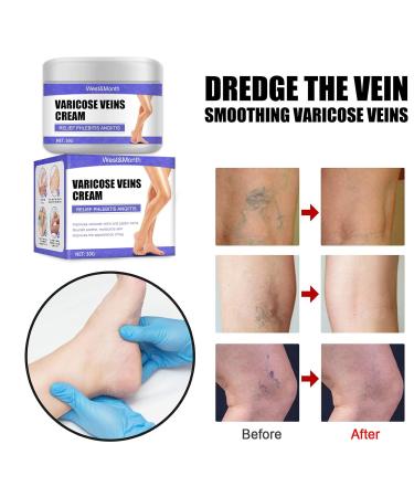 Vasculitis Leg Blood Relief Circulation Vein Pain Remover | Face Pigment Smooth | One Size - Buy Online on GoSupps.com