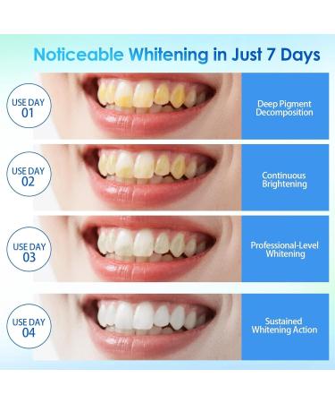 28 Pi ces Bandes De Blanchiment Des Dents Kit Blanchiment Dentaire Confortable Porter Discr tes Sous Les V tements Id al Pour Voyage Bt-cc-hzryt002 - Buy Online on GoSupps.com