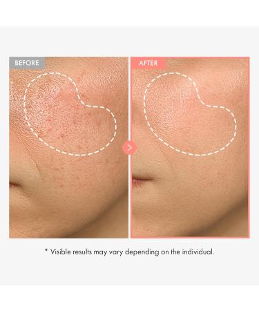 Radiance & Clarity Duo: TOSOWOONG Peach 80 Niacin Serum & Arbutin 7 Tranexamic Acid Cream for Glowing Skin - Buy Online on GoSupps.com