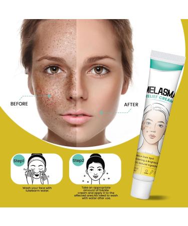  Raxove Dark Spot Remover - Facial Brightening Cream - 20g - Removes sunspots firms the face and corrects pigmentation evens skin tone for most skin types - Buy Online on GoSupps.com