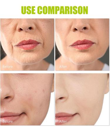 Licorice root extract essential oil skin 338fl Oz Licorice Root Drops Facial Moisturizing Oil Women Dark Spots Removal White Skin Anti Pore ShrinkTeksome - Buy Online on GoSupps.com