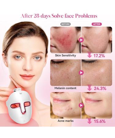 Zupora Red Light Therapy Mask - 7 Color LED Face Rejuvenation & Skin Care | International Shipping - Buy Online on GoSupps.com