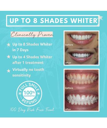 Organic Peroxide Teeth Whitening Kit with LED Light for Sensitive Teeth - Cali White - 2X5mL Gel Syringes, Trays & Case - Buy Online on GoSupps.com