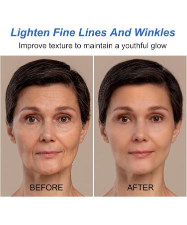 Boto-x Stock Solution Facial Serum Boto-x Stock Anti Aging Serum For Face Instant Face Serum Reduce Fine Lines Wrinkles Boost Skin Collagen Anti-Wrinkle Serum Hydrate & Plump Skin Boto-x Serum - Buy Online on GoSupps.com