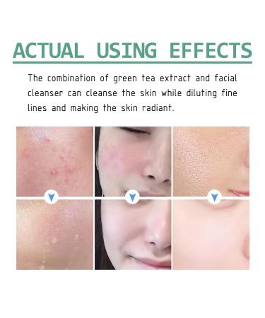 Green Tea Foam Facial Cleanser - Deep Cleansing Fades Acne Scars Whitens Skin Boosts Elasticity & Strengthens Skin Barrier(1PCS) - Buy Online on GoSupps.com