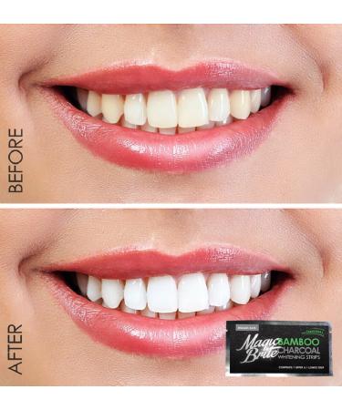 MagicBrite Bamboo Charcoal Teeth Whitening Strips - Premium At-Home Whitening Kit for Bright Smiles | International Shipping Available - Buy Online on GoSupps.com