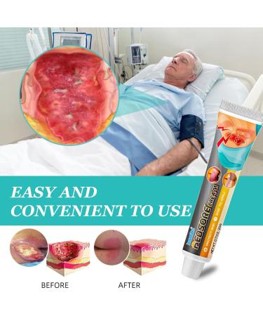 Bed Sore Cream Skin Care Cream Gentle Daily Care for Bed Sores Provides Soothing Support for Home & Nursing Use 0.71Oz - Buy Online on GoSupps.com