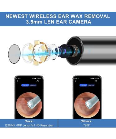 Wireless Ear Otoscope with Camera | Ear Wax Removal Tool | 1296P FHD | 6 LED Lights | Ear Cleaner - Buy Online on GoSupps.com