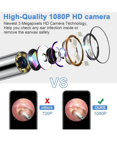 Ear Wax Removal Kit with 1080P HD Camera, 6 LED Lights, IP67 Waterproof - Wireless Ear Endoscope for iPhone, iPad & Android - Black - Buy Online on GoSupps.com
