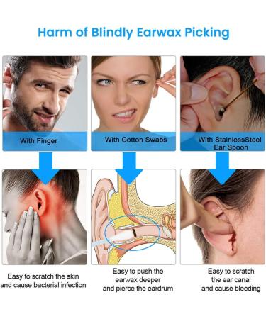 1080P HD Ear Wax Removal Kit with WiFi Endoscope Otoscope - LED Lights, Earwax Remover Tools for iPhone, iPad, Android - Black - Buy Online on GoSupps.com
