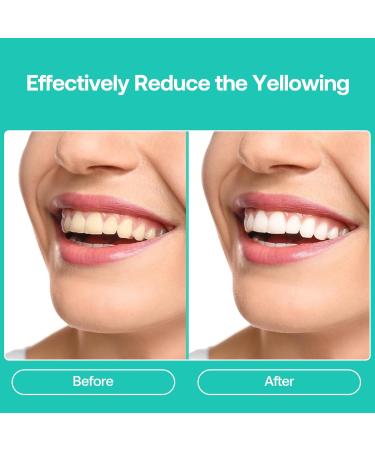 Teeth Whitening Gel Refill (8 Packs) | 35% Carbamide Peroxide | Professional Teeth Bleaching for Fast Results | IMOSTY Whitening Gel 8 x 3ml  - Buy Online on GoSupps.com