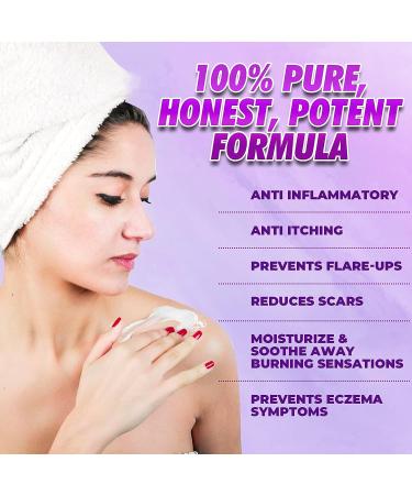 Natrulo Natural Eczema & Psoriasis Cream 2oz Gentle Itch Relief for Adults, Kids & Babies - Buy Online on GoSupps.com