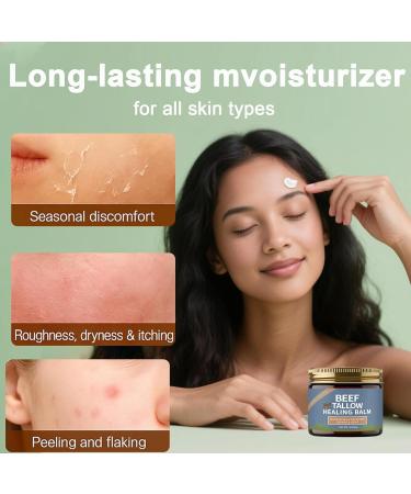 Lala Organics Beef Tallow Healing Balm for the Face Organic Grass Fed Beef Tallow Cream Whipped Beef Tallow for Skin Natural Grassfed Beef Tallow Balm Moisturizer with Manuka Honey 1 Box 1 Ounce (Pack of 1) - Buy Online on GoSupps.com