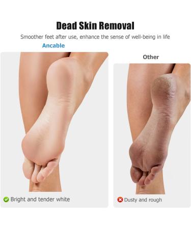 100-Pack Sandpaper Discs for Nail Drill - 2.5mm Metal Pedicure Sanding Disc Bit - Replacement Pads for Electric Foot Files (80 Grit & 150 Grit) - 50 of Each - Buy Online on GoSupps.com