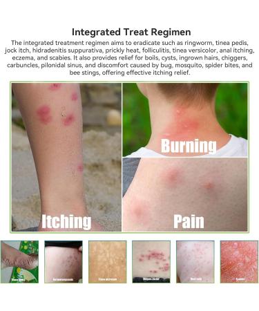 4 PCS Organic Natural Manuka Honey Eczema Ointment Rash Cream Gentle Plant-Based Soothing Balm Psoriasis Jock Itch Irritable Skin Dry Skin Feet Hand All Body Adults & Kids 0.5 Fl Oz (Pack of 4) - Buy Online on GoSupps.com