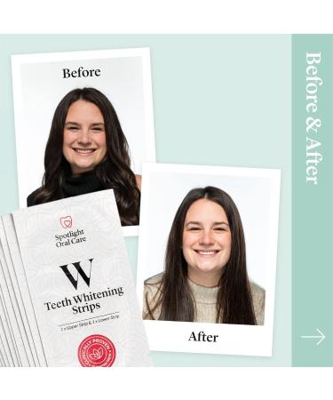 Spotlight Oral Care Teeth Whitening Strips - Hydrogen Peroxide Whitening | 14-Day Course with Whitening Toothpaste - Buy Online on GoSupps.com