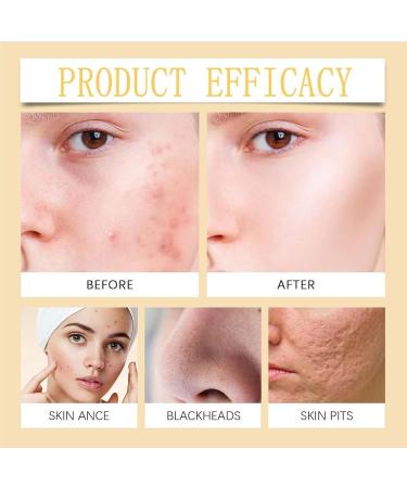 Turmeric facial cleanser 150ml turmeric foaming facial cleanser deep cleansing with brushes natural turmeric foaming cleanser for all skin types - Buy Online on GoSupps.com