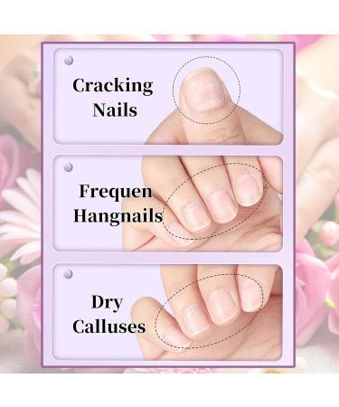 Stylo repousse-cuticules en c ramique nouveau stylo huile pour ongles 3 en 1 am lior (2025) crayon cuticules repousse-huile pour ongles incarn s (1pcs) - Buy Online on GoSupps.com