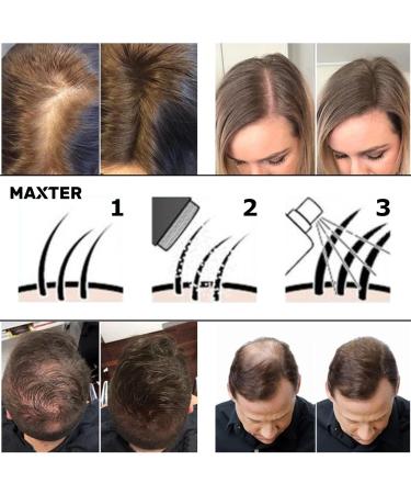Bunee Hair Fibres - Hair Thickener - Hair Loss Coverage in 30 Seconds - 100% Natural Cotton Hair Powder Women and Men (Medium Brown 27.5g) - Buy Online on GoSupps.com