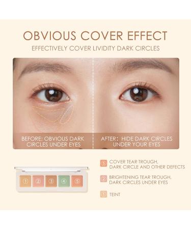 5-Color Multi-Purpose Concealer for Dark Circles Blemishes & Freckles - High-Glue Moisturizing Correction | International Shipping - Buy Online on GoSupps.com