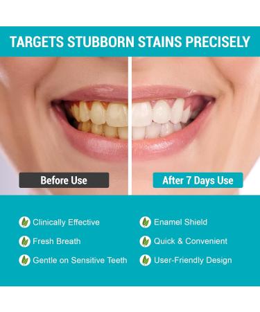 Pap Dry Teeth Whitening Strips 14 Count No Gel Residue Dentist Recommended Sensitivity-Free Formula Enamel Safe Mint Fresh Whitener for Coffee Tea Stains Removal 7 Treatments - Buy Online on GoSupps.com