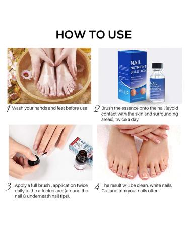 Nail Repair Solution - Moisturizing Oil for Healthy Nails Restored Cuticles & Glossy Finish - Shop Now! - Buy Online on GoSupps.com