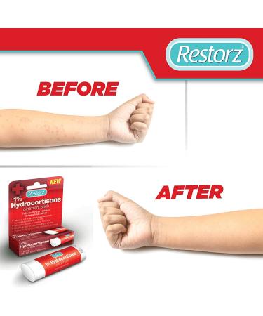 Restorz Hydrocortisone 1% Cream Stick for Fast Relief | Itching, Redness, Rashes | Easy-to-Use No Mess Ointment | Gentle Support | 1 Pack - Buy Online on GoSupps.com