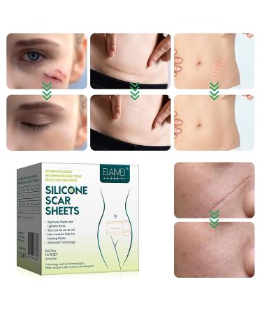 Medical Grade Silicone Scar Tape Roll - 1.6x120 | Professional Scar Removal for C-Section, Surgery, Burn, Keloid, Acne | Reusable Silicone Strips - Buy Online on GoSupps.com