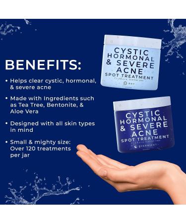 Day & Night Cystic Spot Treatment Kit by Ayadara - Salicylic Acid Cream & Overnight Sulfur Treatment for Hormonal & Severe Acne - Buy Online on GoSupps.com