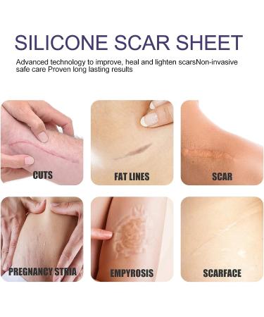 Silicone Scar Tape Roll - Professional Reusable Sheets for Surgical Caesarean Scar Removal - Buy Online on GoSupps.com