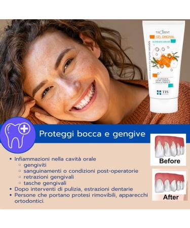 TISODENT Gel gingival 50 ml - Buy Online on GoSupps.com