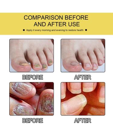  MagiSel Nail strengthening nail strengthening polish nail care oil with ginseng oil repairs and strengthens damaged nails 10 ml - Buy Online on GoSupps.com