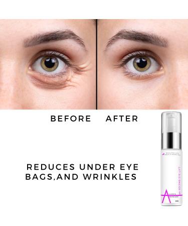 Allurica Skincare Eye Serum and Under Eye Cream for Wrinkles | Dark Circle Remover and Anti-Aging Treatment for Skin Tightening - Buy Online on GoSupps.com