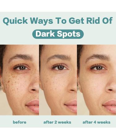 Dark Spot Remover for Face - 3PCS Dark Spot Corrector Cream for All Skin Tones - Melasma, Freckle, Sun Spot Remover & Blemish Reducer 2.1 FL OZ - Buy Online on GoSupps.com