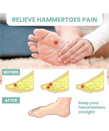 Welnove Hammertoe Corrector Gel Toe Straighteners - 8 Pcs Firm Support Pads for Bent Crooked & Hammer Toes - Cushioned Relief in Beige - Buy Online on GoSupps.com